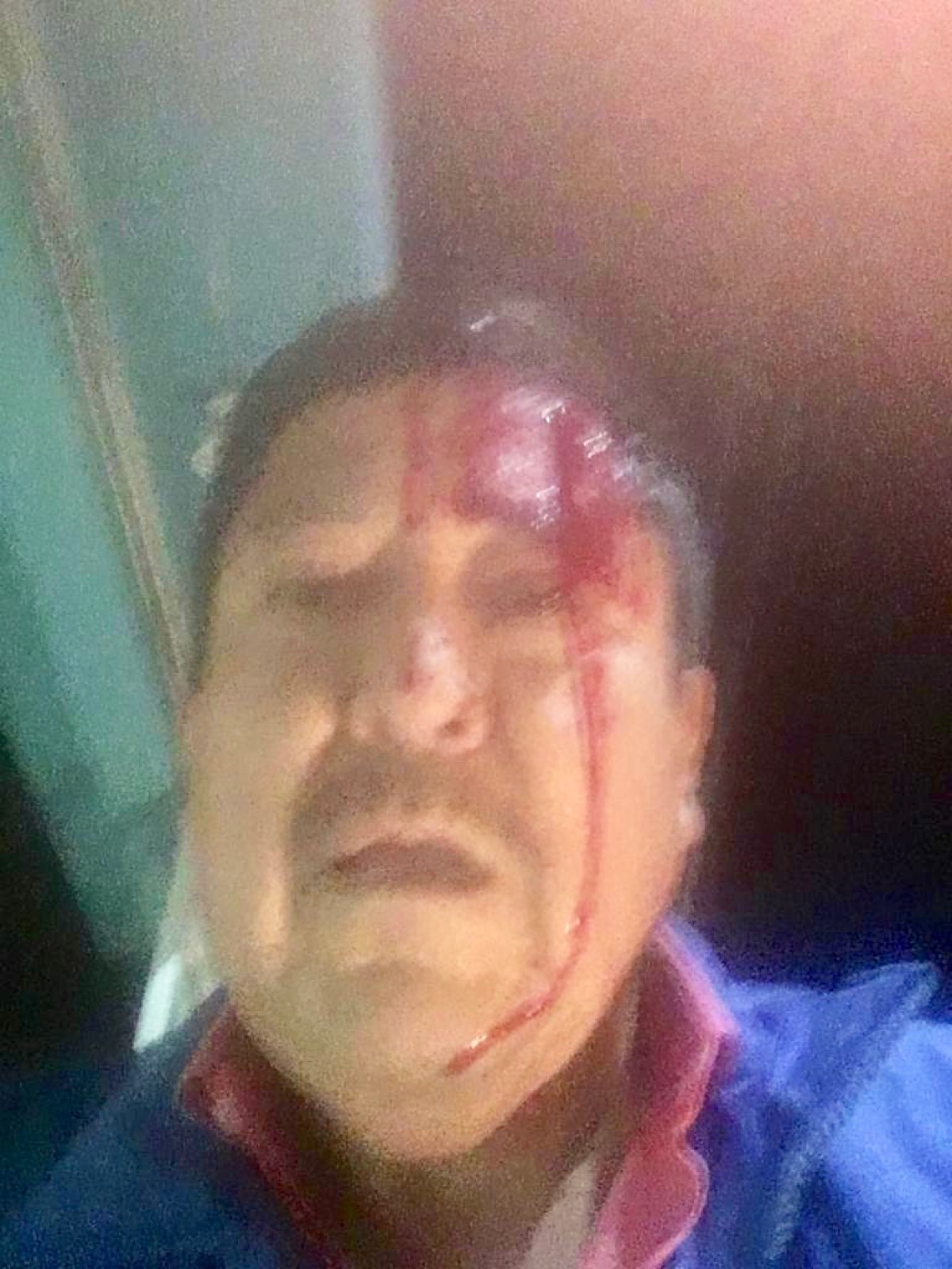 Agreden a batazos a periodistas en BCS